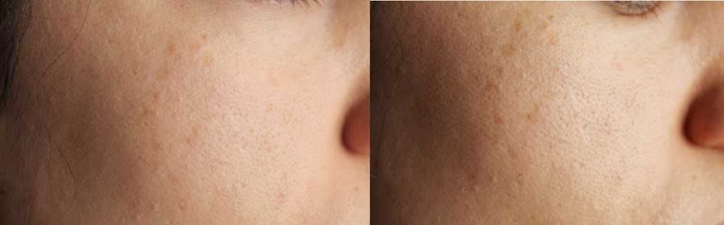 Si haces click en la imagen podrás verla en muy alta resolución Si haces click en la imagen podrás verla en muy alta resolución